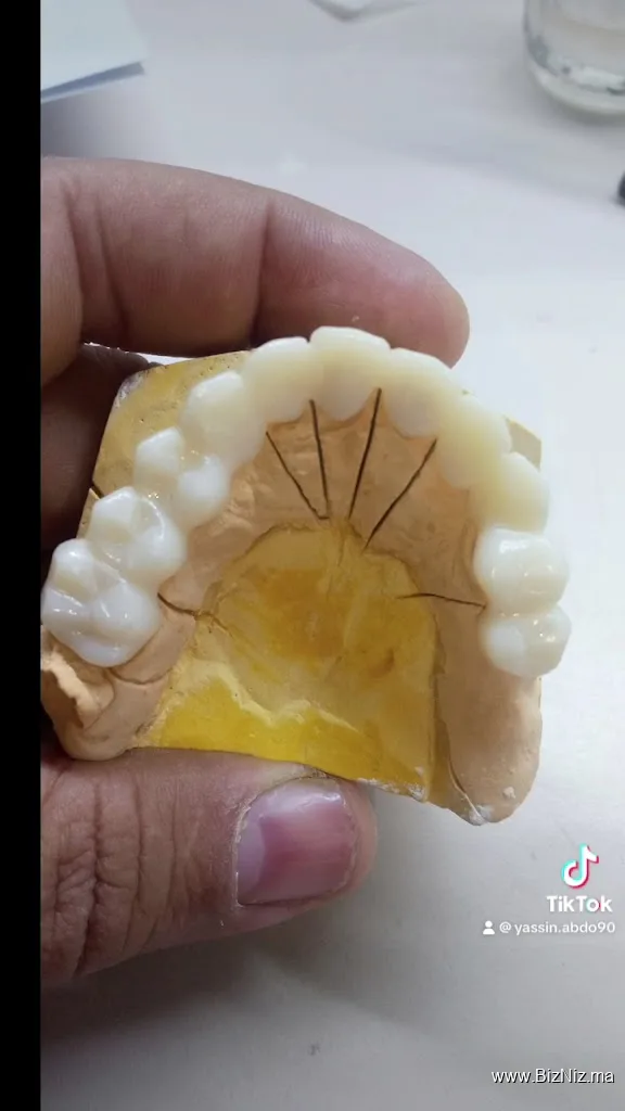 Laboratoire de prothèse dentaire